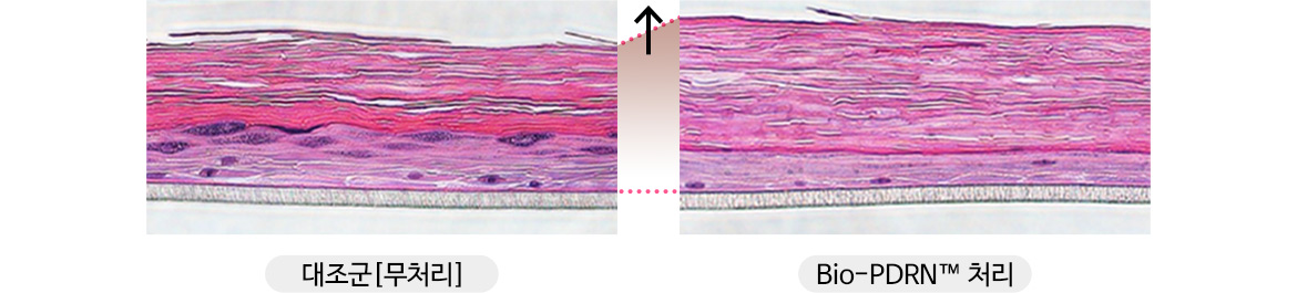 왼쪽 : 대조군[무처리] / 오른쪽 : Bio-PDRN™ 처리