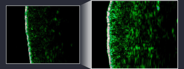 사용 전과 4주 사용 후 피부 치밀도 개선 비교 이미지
