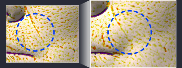 사용 전과 4주 사용 후 팔자 주름 개선 비교 이미지