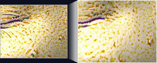 사용 전에 비해 사용 후 모공 수, 면적 개선 측정