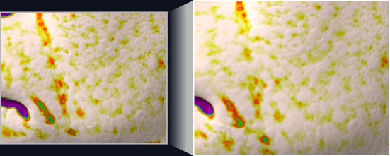 사용 전에 비해 사용 후 팔자주름 개선 측정