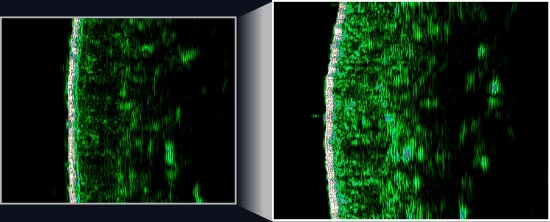 사용 전에 비해 사용 후 피부 치밀도가 개선된 모습