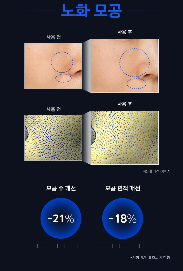 아이오페 레티놀 슈퍼 바운스 세럼