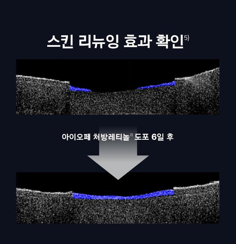 아이오페 레티놀 슈퍼 바운스 세럼