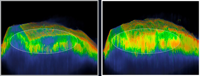 사용 전에 비해 사용 후 피부 탄력층 142% 강화