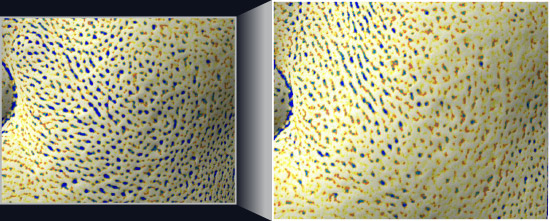 사용 전에 비해 사용 후 노화 모공 측정 비교