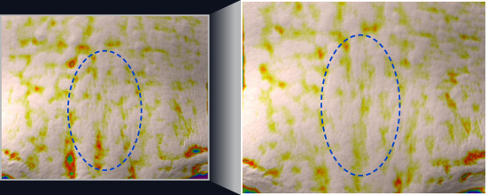 사용 전에 비해 사용 후 주름 개선 측정