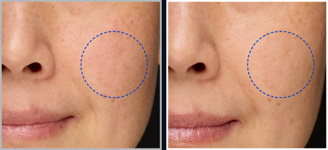 사용 전에 비해 사용 후 피부결이 나아지고 광채가 생긴 모습