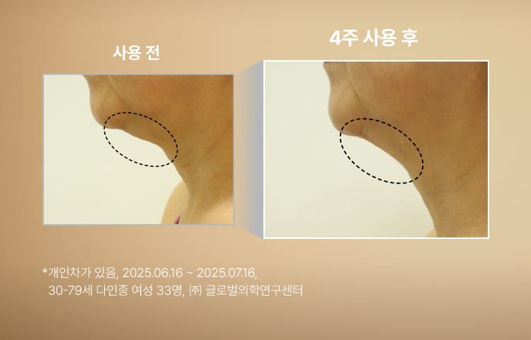 슈퍼바이탈 넥 앤 데콜테 크림