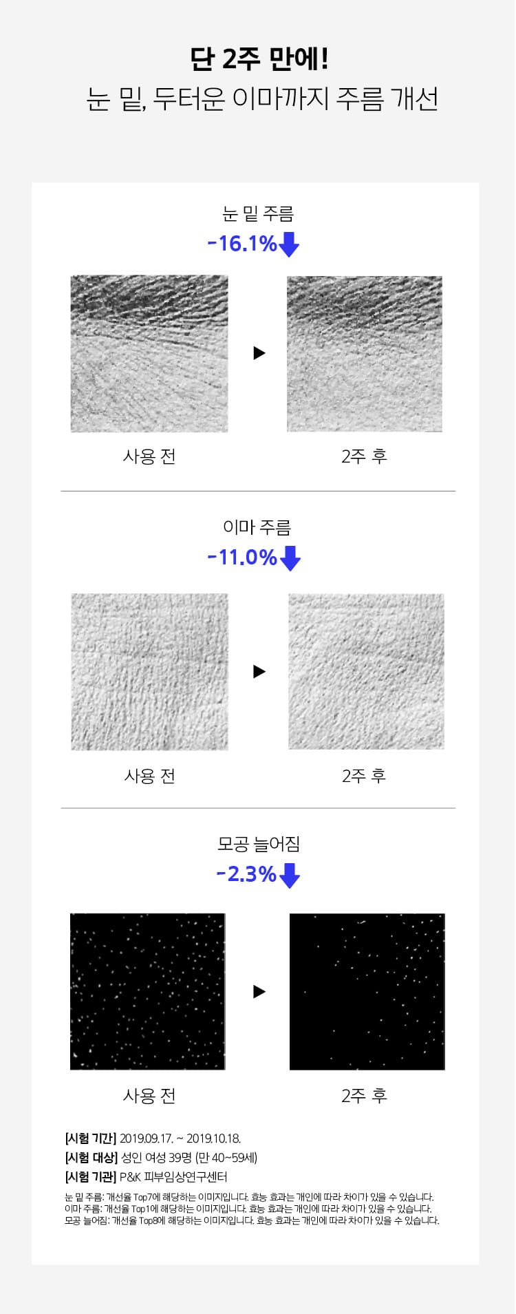 In just 2 weeks!  Improves wrinkles under the eyes and even on the thick forehead