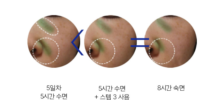 5일차 5시간 수면 < 5시간 수면 + 스템3 사용 = 8시간 수면