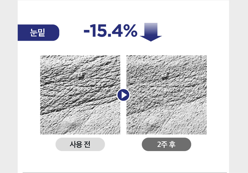 사용 2주 후 눈밑 주름 15.4% 감소