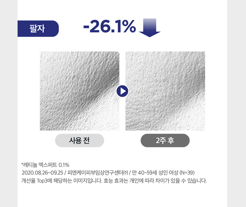 사용 2주 후 팔자 주름 26.1% 감소