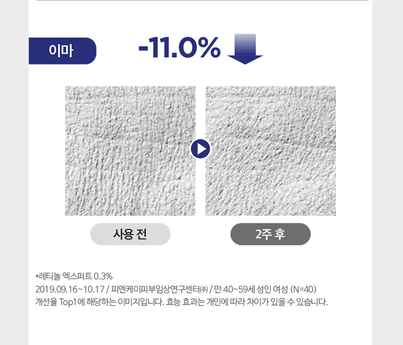 사용 2주 후 이마 주름 11.0% 감소