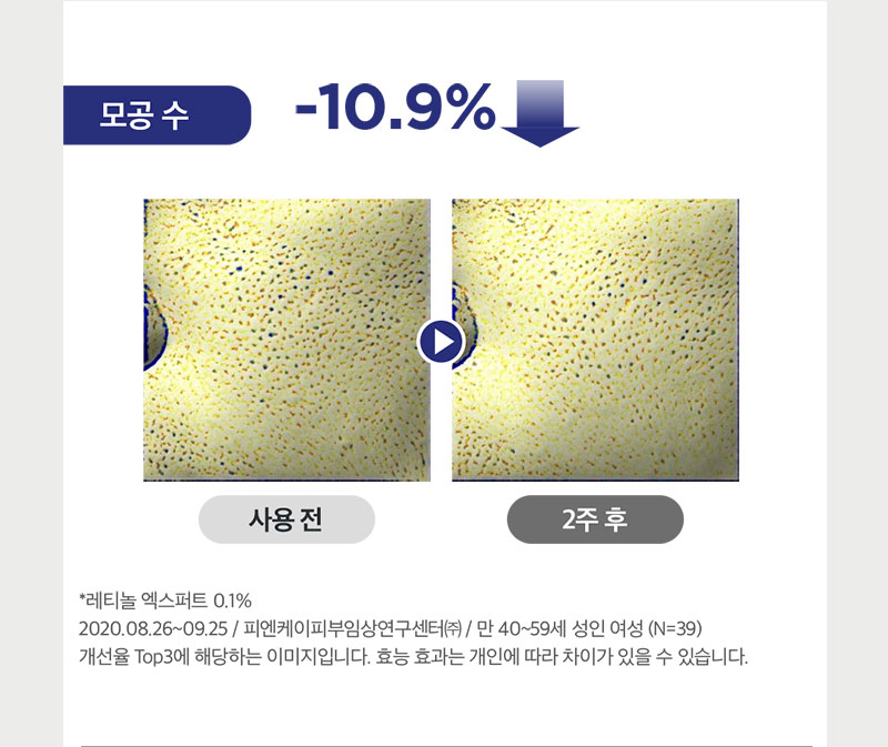 사용 2주 후 모공 수 10.9% 감소