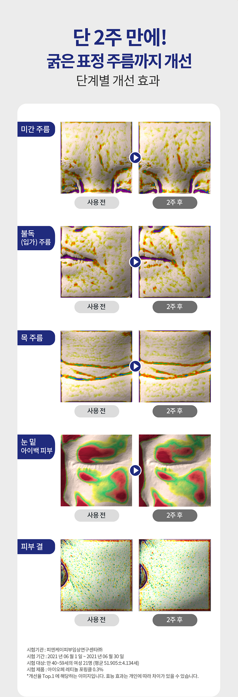 하단 텍스트 참조