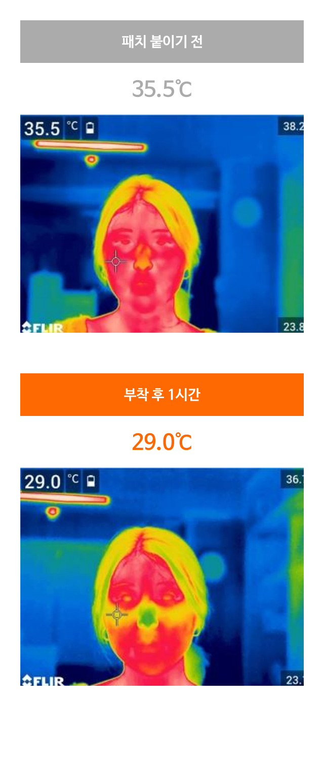 패치 붙이기 전:35.5도 부착 후 1시간:29.0도